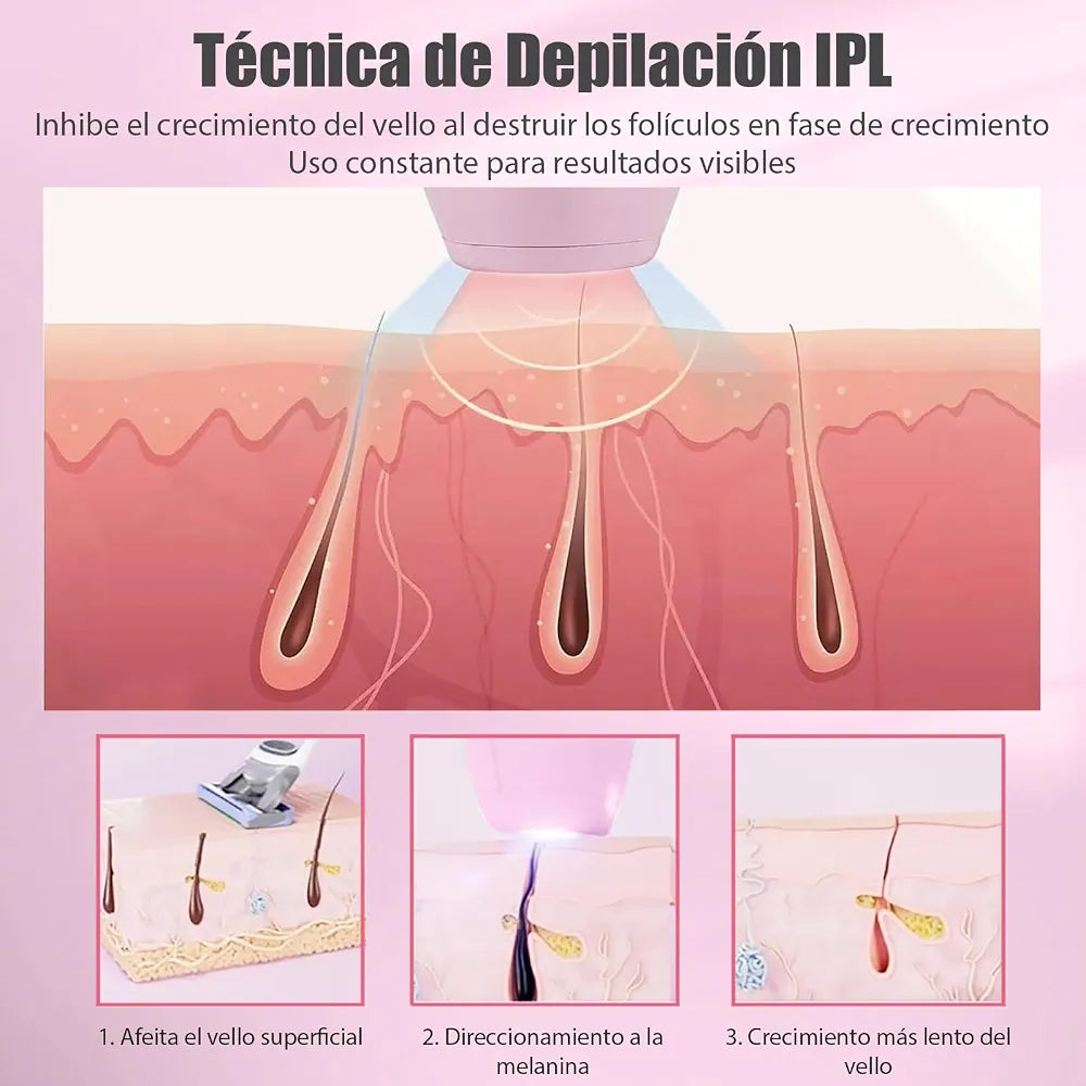 Depiladora IPL de Luz Pulsada para Uso en Casa